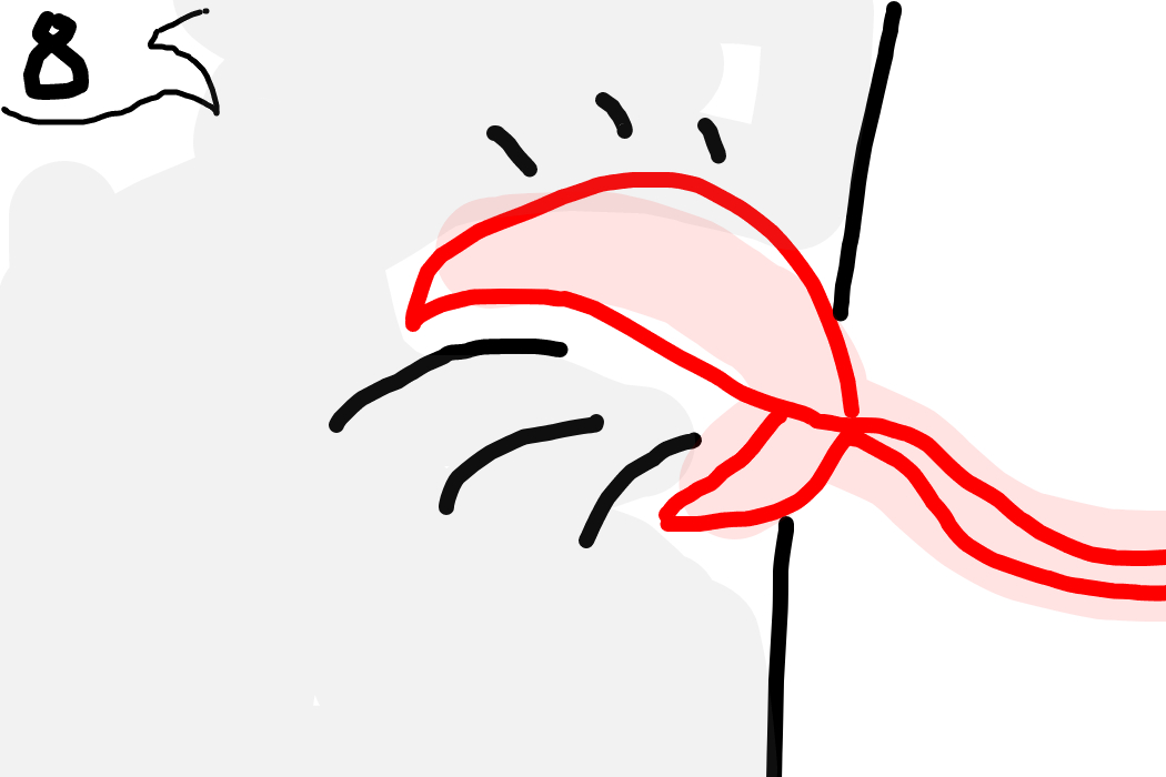 8. Благодаря крабику я проснулся через 3 дня, а мог бы и 3 недельки!